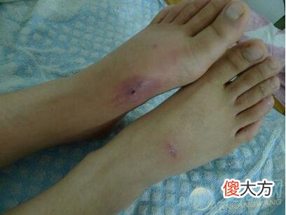 梦见蛇咬脚是什么预兆,梦见蛇咬脚是什么预兆 梦见蛇咬脚是什么预兆,梦见蛇咬脚是什么预兆